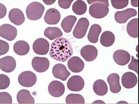 Giải mã DNA của ký sinh trùng gây bệnh sốt rét