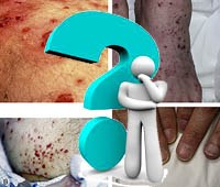 Trả lời câu hỏi bạn đọc về chuyên đề sốt rét, ký sinh trùng, côn trùng y học tháng 6 & 7 năm 2012