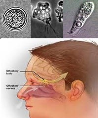 Cảnh báo loại amíp tự do bất thường ký sinh gây bệnh “ăn não người”