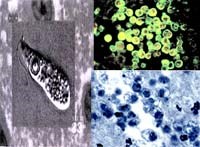 Những ý kiến thảo luận của các nhà khoa học xung quanh ca bệnh amip ăn não người  