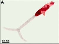 Viêm da mày đay ở người do ấu trùng sán máng vịt