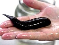 Lợi và hại của con đỉa