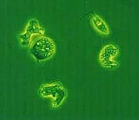 Thêm một bệnh nhi nghi tử vong do amip ăn não