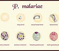 Điều trị sốt rét do nhiễm ký sinh trùng sốt rét Plasmodium malariae