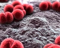 Điều tra viêm màng não do tác nhân nấm tại Mỹ