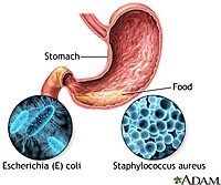 Tình hình ngộ độc thực phẩm và vệ sinh an toàn thực phẩm thời gian cận Tết