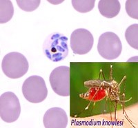 Có thể phát hiện nhiễm ký sinh trùng sốt rét Plasmodium knowlesi ở người bằng test chẩn đoán nhanh (RTDs)