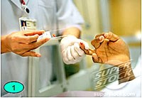 Ưu, nhược điểm của các phương pháp và kỹ thuật nghiên cứu đánh giá ký sinh trùng sốt rét nhạy, kháng thuốc  