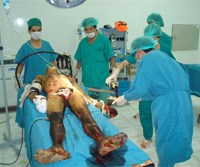 Thảm họa do bom mìn, nỗi đau còn đó