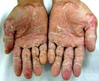 Điểm báo về các thông tin liên quan đến y tế từ ngày 8/3 đến 12/3 năm 2013