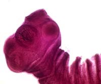 Phân biệt sán dây lợn và sán dây bò