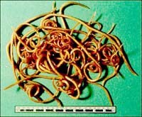 Tính đặc hiệu của miễn dịch immunoblot trong chẩn đoán bệnh viêm màng não có tăng bạch cầu ái toan (EOM)