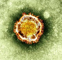 Bộ Y tế chỉ đạo ứng phó với dịch cúm A (H7N9)