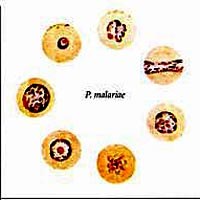 Khánh Hòa và đặc thù sốt rét Plasmdium malariae