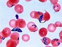 Phát hiện chủng ký sinh trùng sốt rét kháng thuốc tại Campuchia