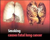 Phòng chống tác hại của thuốc lá