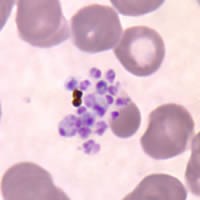 Những nghiên cứu mới về ký sinh trùng sốt rét trên thế giới