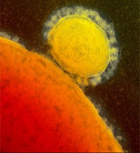 Dịch do virus MERS gây chết người lặng lẽ ở Ả rập xê út làm nản lòng các chuyên gia Y tế thế giới