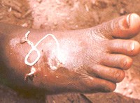 Tổng hợp thông tin về liệu pháp điều trị các bệnh ký sinh trùng