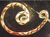 Nhân trường hợp nhiễm trùng thần kinh do ký sinh trùng: tổng hợp y văn về hai tác nhân gây bệnh viêm màng não tăng bạch cầu ái toan Angiostrongylus & Gnathostoma 