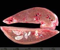 Đôi điều bàn luận từ ca bệnh nhiễm sán lá gan lớn Fasciola hepatica  kháng thuốc triclabendazole tại Hà Lan