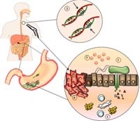 Một số bằng chứng dựa trên y học chứng cứ về vai trò của vi khuẩn Helicobacter pylori trong bệnh ung thư dạ dày 