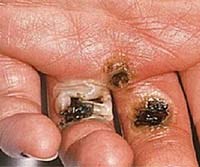 Cảnh báo tai nạn có thể gây chết người do bỏng điện