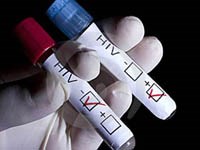 Thông báo của Bộ Y tế về công tác xét nghiệm HIV