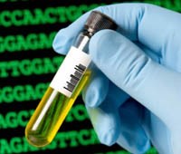 Các test mới dùng để phát hiện sốt rét kháng thuốc. Có thể phát hiện chính xác và nhanh chóng các nguyên nhân gây nhiễm trùng huyết dẫn đầu