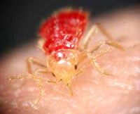 Bệnh sốt chiến hào do rận truyền