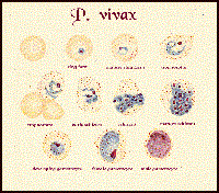 Điểm tên một số tài liệu nghiên cứu mới nhất về thử nghiệm lâm sàng thuốc sốt rét với Plasmodium falciparum, Plasmodium vivax