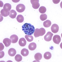 Sốt rét do P.vivax có thể tiến hóa với cơ chế bảo vệ tự nhiên