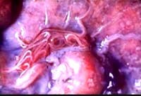 Tổng hợp y văn toàn cầu về bệnh ký sinh trùng truyền từ động vật sang người đang nổi qua trường hợp viêm não tăng bạch cầu ái toan do giun 