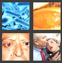 Thế giới tiếp tục đạt được nhiều thành quả quan trọng trong một thập niên tiếp cận bệnh nhiệt đới bị lãng quên (2003-2013) 