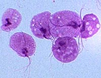 Trùng roi âm đạo gây bệnh ở nam giới