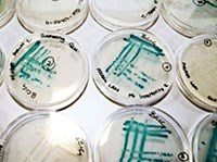 Có thể sản xuất một vaccine sốt rét giá rẻ từ vi khuẩn E.Coli