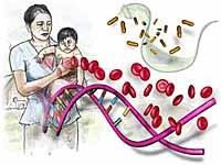 Bệnh Chagas lây truyền từ mẹ sang con xảy ra ở Nhật Bản không còn đặc hữu tại các quốc gia châu Mỹ