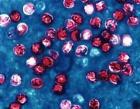 Đơn bào Cryptosporidium gây bệnh ở người