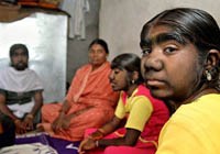 Một số hội chứng và bệnh lý hiếm gặp trên thế giới