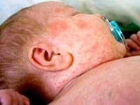 Điểm báo về các thông tin liên quan đến y tế từ ngày 8/2 đến 10/2 năm 2014