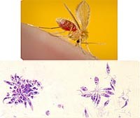 Thông tin cập nhật về phòng chống bệnh Leishmaniasis-một bệnh nhiệt đới bị lãng quên