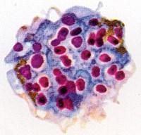 Cập nhật thông tin ký sinh trùng sốt rét Plasmodium falciparum kháng thuốc Artemisinine trên thế giới đầu năm 2014