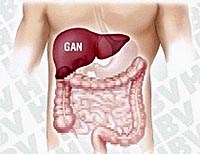 Sự khác biệt của bệnh viêm gan A và viêm gan B