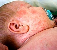 Điểm báo về các thông tin liên quan đến y tế từ ngày 21/2 đến 23/2 năm 2014