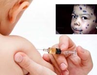 Điểm báo về các thông tin liên quan đến y tế ngày 5/3 năm 2014