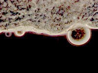 Môi trường ảnh hưởng đến khả năng của vi khuẩn ngăn chặn sự lan truyền sốt rét