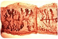 Phòng chống nang sán/sán dây