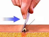 Sinh thái học côn trùng luôn là điều “bí ẩn”