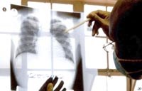 Nhóm hoạt động xã hội kêu gọi Nam Phi tuyên bố Lao là một vấn đề khẩn cấp về y tế công cộng