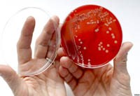 Nghiên cứu phát hiện tính dễ bị tổn thương ở vi khuẩn kháng với kháng sinh và phát triển điều trị thử nghiệm với virus Nipah gây chết người